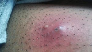 Apseye İyi Gelen Bitkisel Banyolar