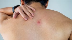 Apseye İyi Gelen Bitkisel Şifalı Yağlar