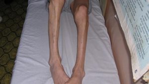 Kas İncelmesine İyi Gelen Bitkisel Banyolar