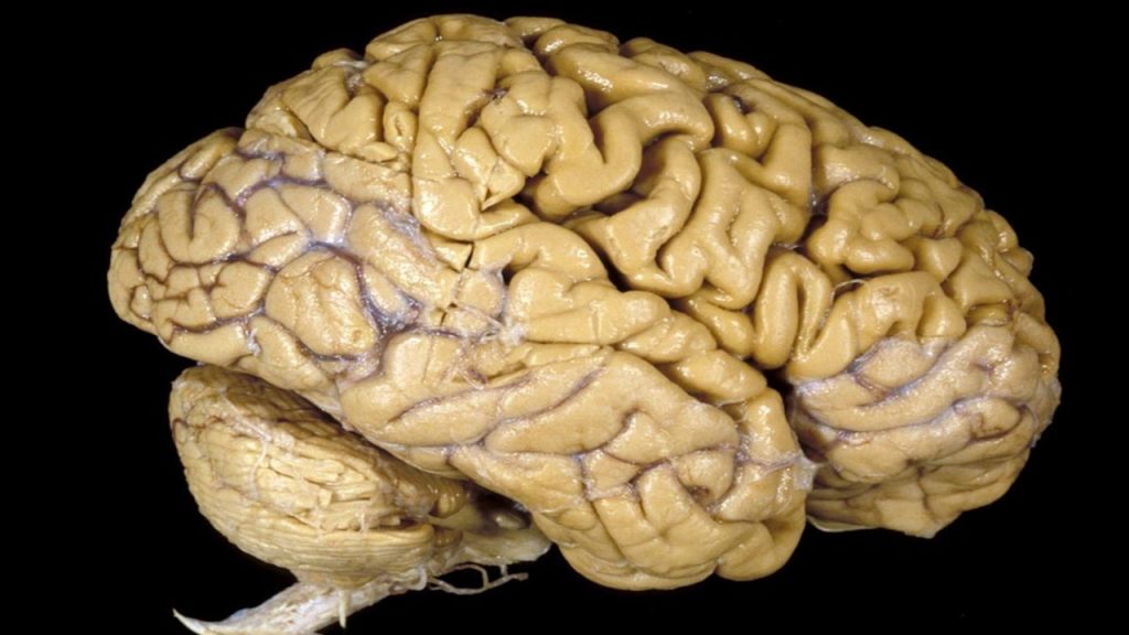 Beyin kanaması sonucu beyin kabuğu çalışmayan bir insanda işlevlerinden hangilerinin gerçekleşmesi beklenmez?