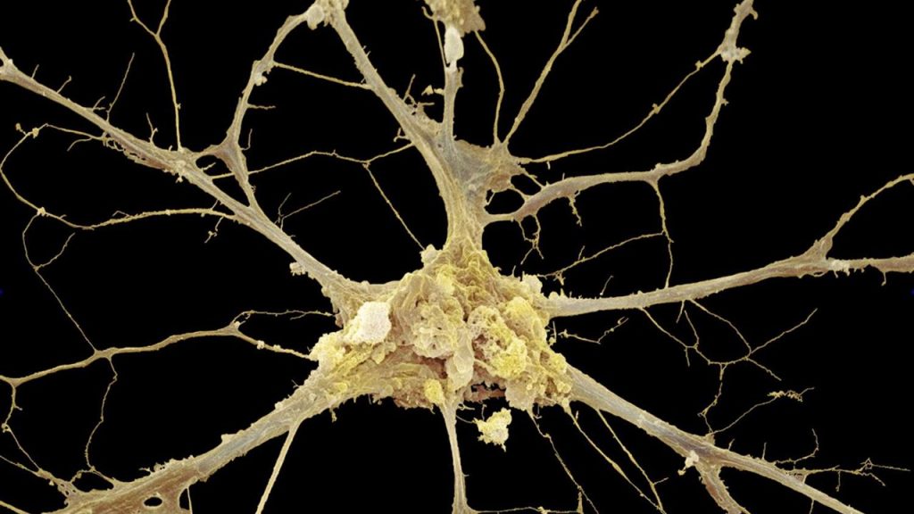 Biyoloji Ders Notları – Sinir Doku Ders Notları
