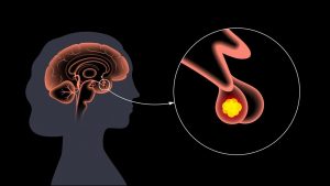 Hipotalamus tarafından salgılanan RH (salgılatıcı hormon); unsurlarından hangilerini uyarır?