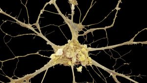 Sinir hücrelerinde aşağıdaki olaylardan hangisi gözlenemez?