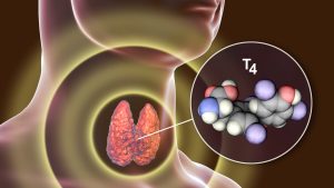 Tiroit bezinin büyük kısmı tahrip edilen bir kobayda aşağıdaki hormonlardan hangisinin miktarında artış gözlenmesi beklenmez?