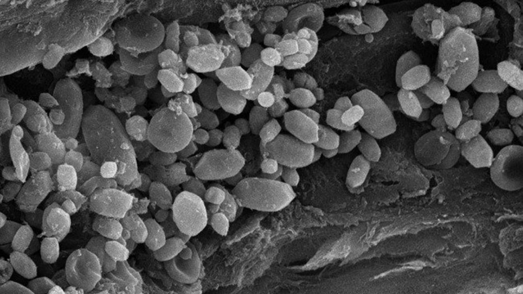 CaCO3 yapılı otolit taşlarına unsurlarından hangilerinde rastlanır?