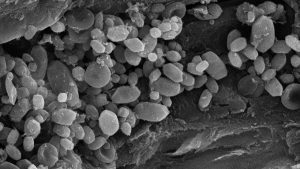 CaCO3 yapılı otolit taşlarına unsurlarından hangilerinde rastlanır?