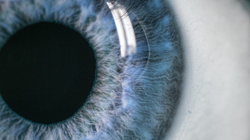 Gözün yapısı ile ilgili yargılarından hangileri doğrudur?