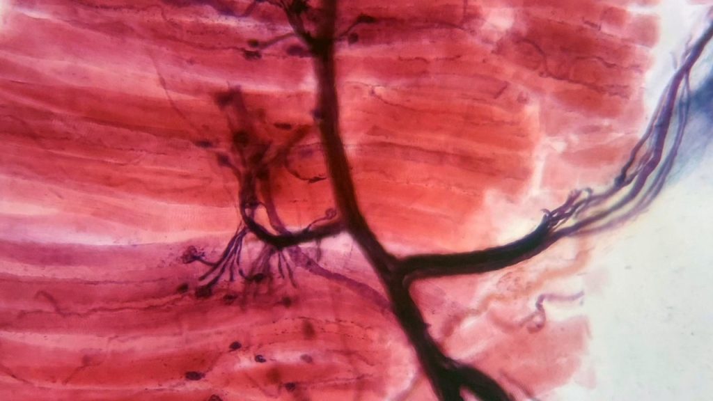 Kaslarımızın kasılma mekanizması ile ilgili aşağıdaki açıklamalardan hangisi yanlıştır?