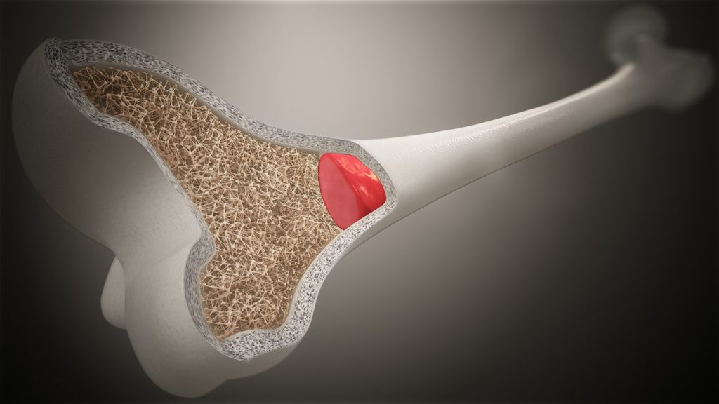 Uzun kemiklerde gözlenen yapılardan hangileri kısa, yassı ve düzensiz kemiklerde de gözlenir?