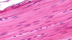 Kalp kasının özelliklerinden durumlarından hangileri düz kas çeşitlerinde de gözlenir?