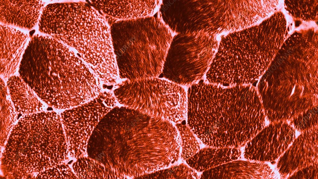 Yetişkin bir insanda laktik asit fermantasyonu enzimleri aşağıdaki hücrelerden hangisinden izole edilebilir?