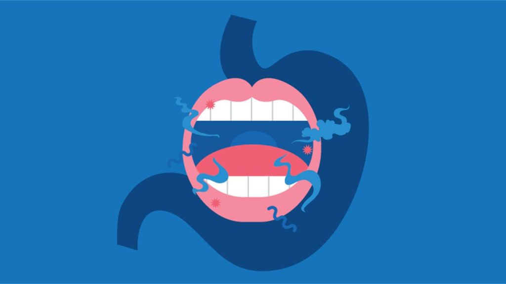 Ağız Kokusu Sebepleri, Belirtileri ve Tedavisi