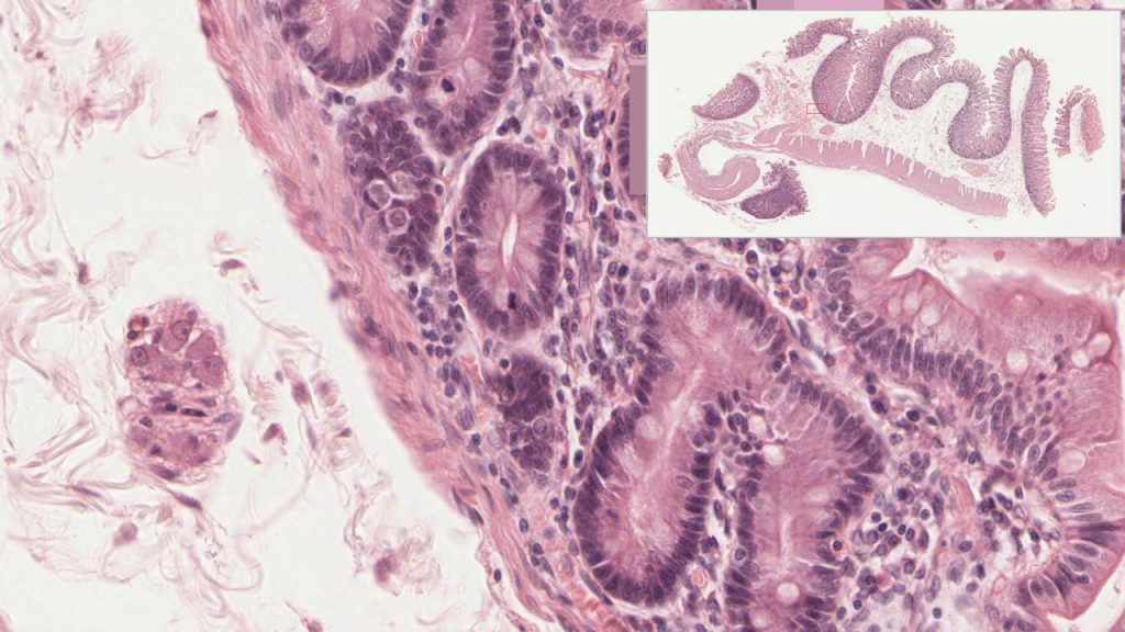İnce bağırsak mukoza hücreleri tarafından emilen yağ monomerleri kalbin sağ kulakçığına gelince kadar yapılarından hangilerinde rastlanmaz?