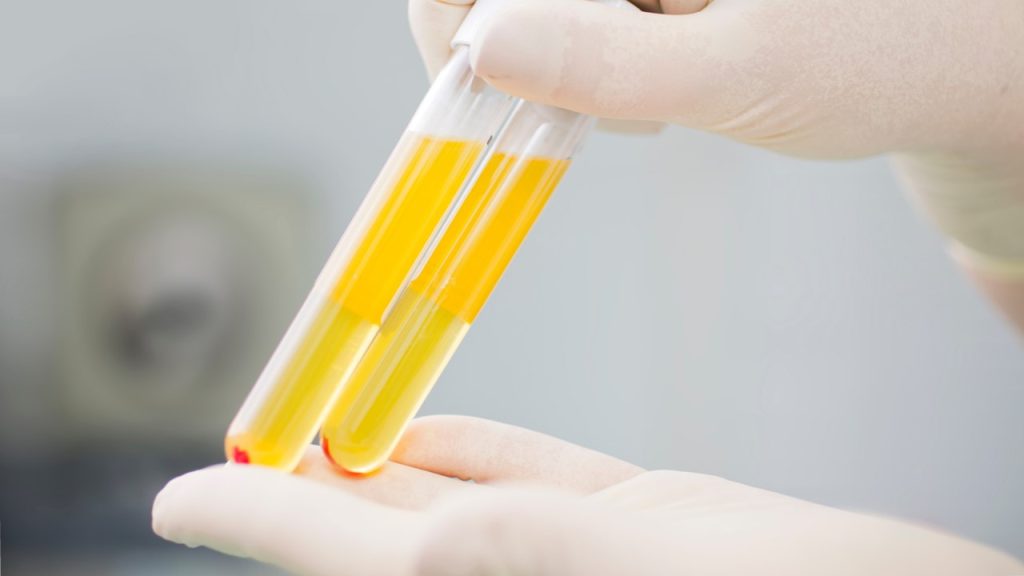 Kan dokuda vücut hücrelerinin ihtiyacı olan besinler kanın hangi yapılarından taşınır?