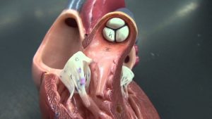 Kulakçıklar sistol durumunda iken hangisi gerçekleşmez?