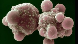 Apoptotik hücre ölümü