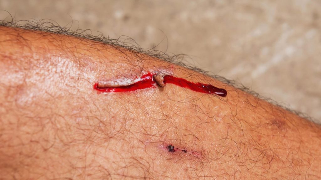 Hangisi ilkyardımcının görevlerinden birisi değildir?