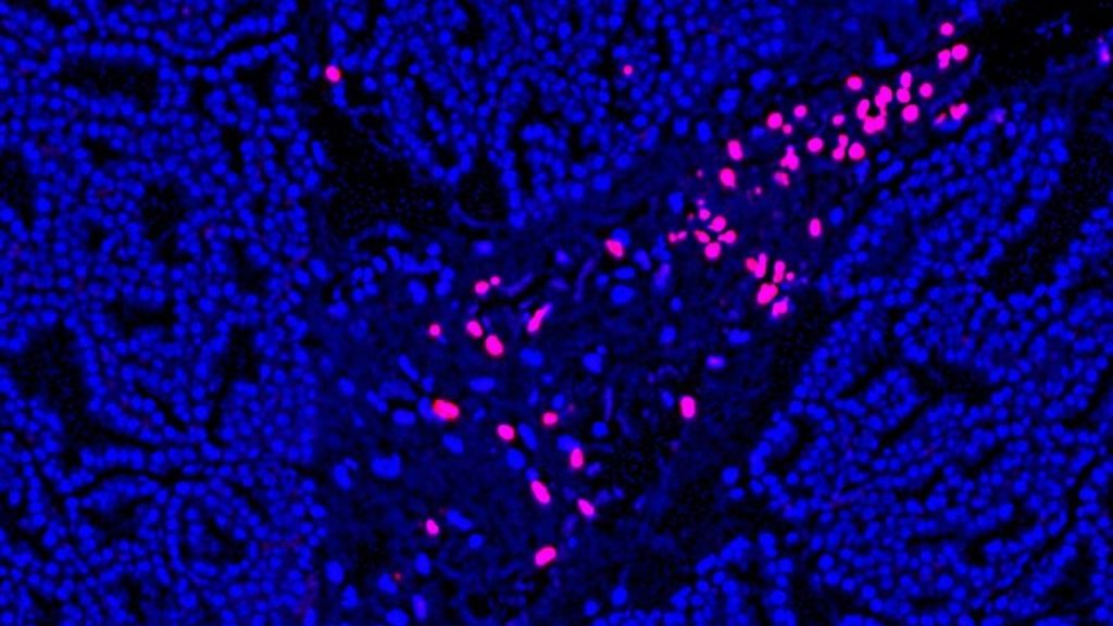 Tunel Yöntemi Apoptosis