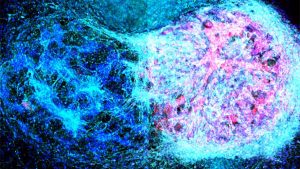 Hücre zedelenmesine ait bulgulardan zedelenmenin irreversible olduğu gösteren belirtiler nelerdir?