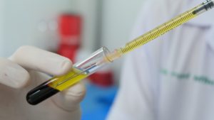 Kanın sıvı kısmına ne denir?