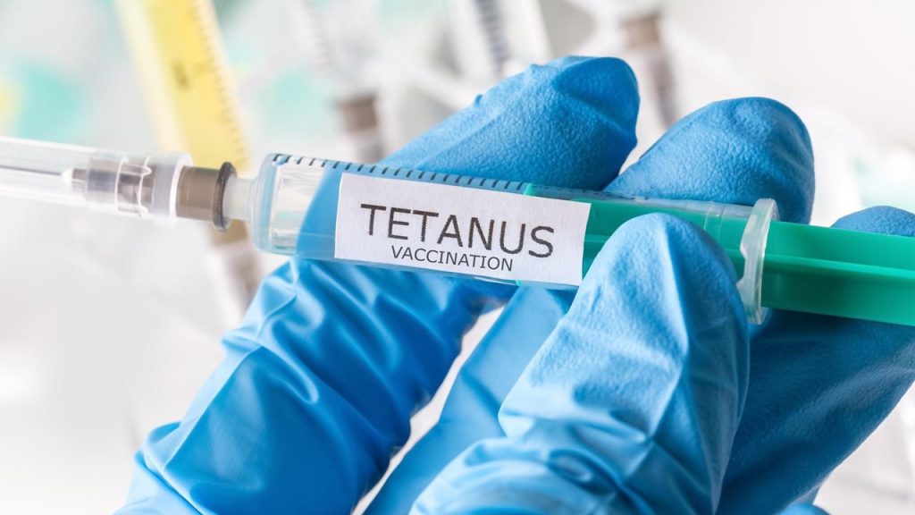 Yaşlılara her 10 yılda bir yapılması gereken aşı aşağıdakilerden hangisidir?