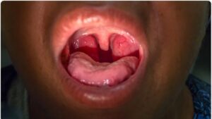 Bademcik nerede bulunur?