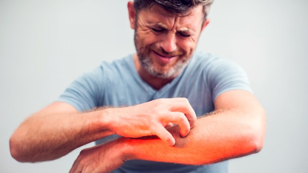 Kaşıntıya İyi Gelen Akapunktur Noktaları