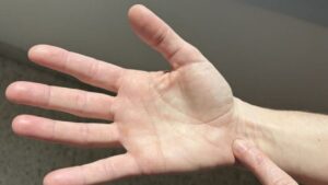 Mide Ağrısına İyi Gelen Akapunktur Noktaları