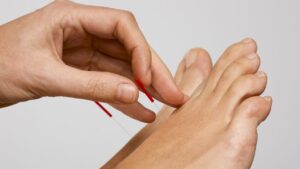 Romatizmaya İyi Gelen Akapunktur Noktaları