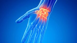 El ile kolun birleştiği bölüm