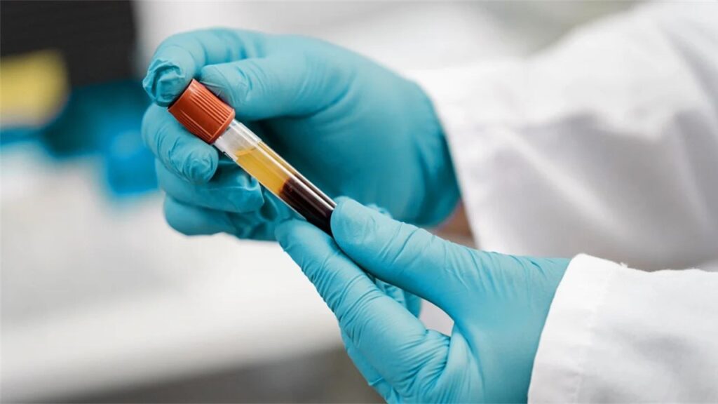 İnsan vücudundan alınan örneklerin incelenmesi