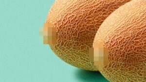 Meme Küçültme Sonrası Şişlik Ne Zaman İner?