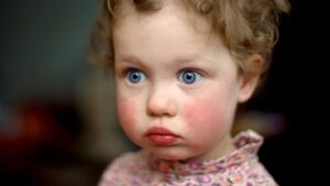 My mom’s cheeks turn red like _____ when she’s angry.