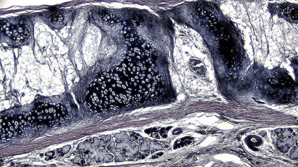 Kıkırdak doku ile ilgili aşağıdaki ifadelerden hangisi yanlıştır?