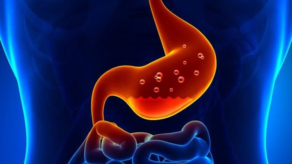 Yukarıdakilerden hangileri mide asitinin görevleri arasında yer alır?